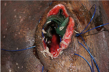One of the two methods for applying the maggots involved placing a net under the edges of the wound onto which the maggots were placed