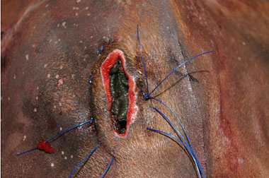 The net is then closed and sutured to hold the maggots in place within the wound