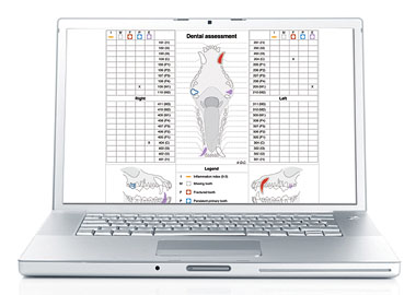 Laptop showing dental assessment on screen