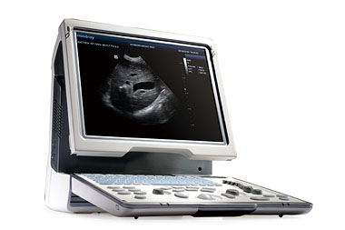 Mindray DP50 ultrasound scanner from BCF