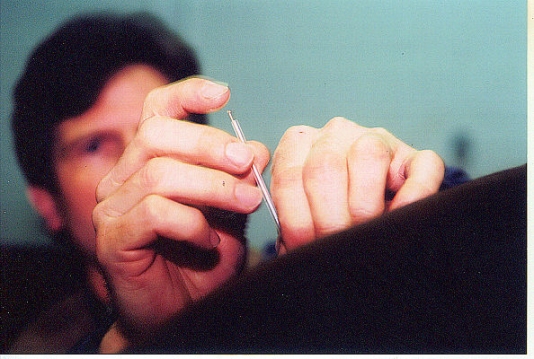 Acupuncturetitle=