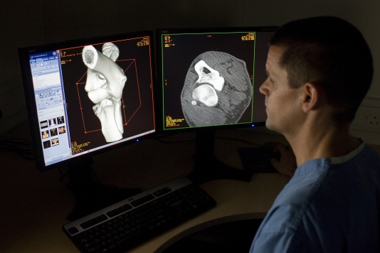 An orthopaedic surgeon viewing CT imagestitle=