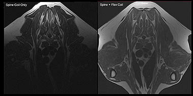 Spine comparison image
