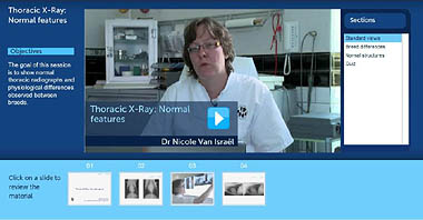 Screenshot of Thoracic X-ray module