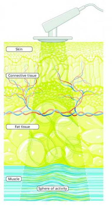 Illustration of layers of skin