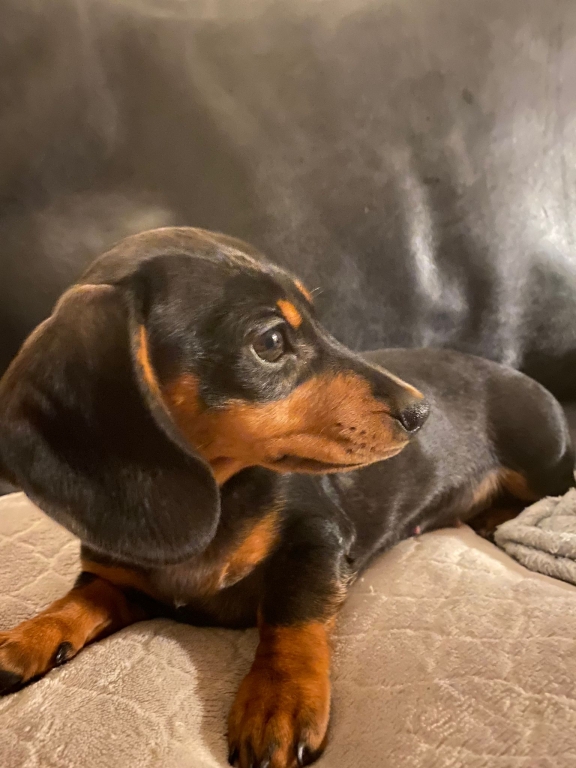 Lilly had been in contact with hormonal cream containing oestrogen (HRT).