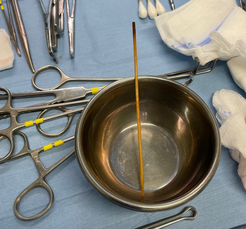 Vets at a Davies Veterinary Specialists have successfully removed a kebab skewer from a much loved pet.