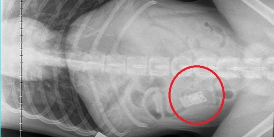 X-ray showing Nintendo DS inside stomach