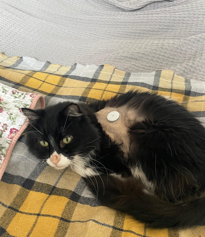 Eric’s blood glucose levels were monitored by attaching a sensor.