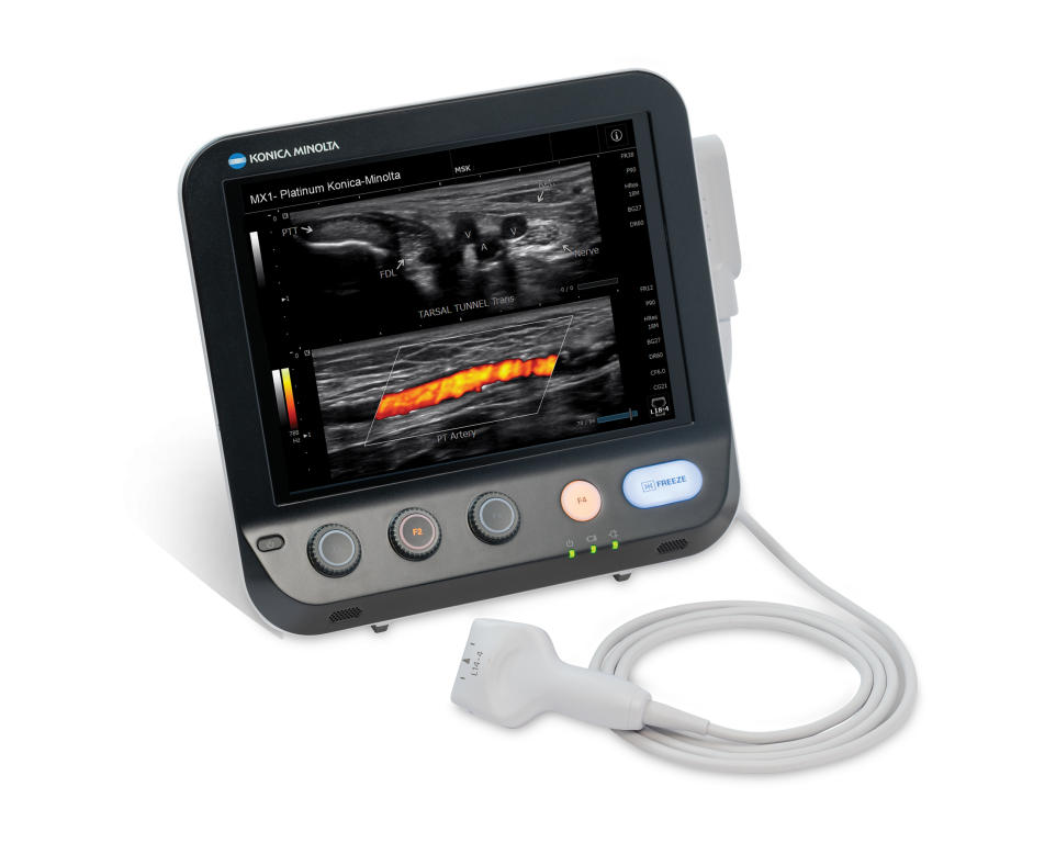 KM Ultrasound system image (SONIMAGE® MX1 Platinum)