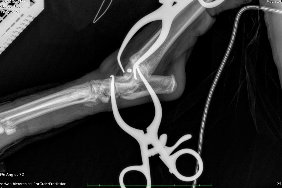 Mark opted for an innovative solution: a headless compression screw commonly used in human orthopaedic surgery