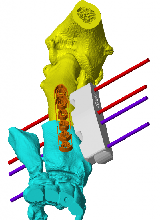 3D printer image of Baxter's leg