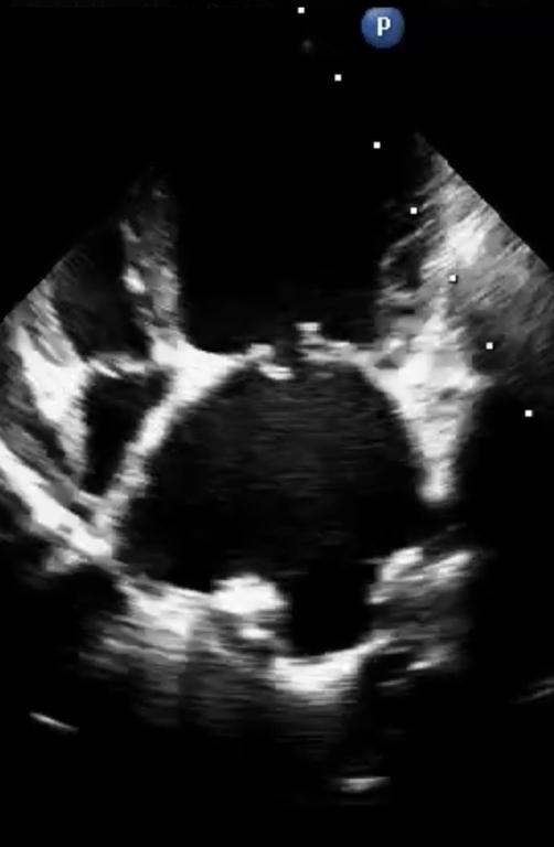 With thanks to Pablo Donati