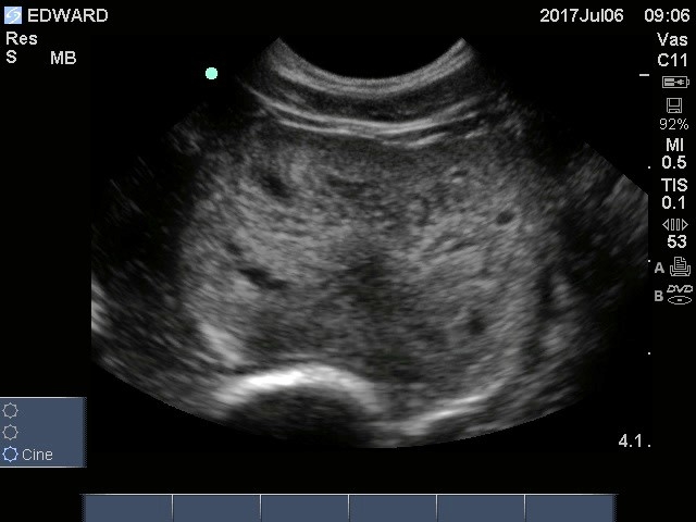 An ultrasound of a dog with prostatic disease