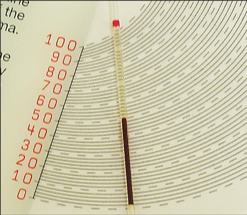 Dogs with MMVD may develop reductions in PCV / Veterinary Industry News