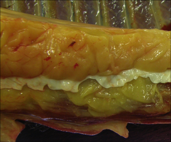 Post mortem image of the ventral abdominal wall of an obese pony 