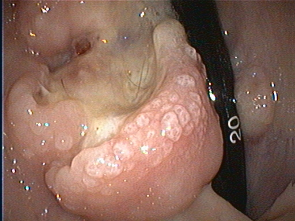 An endoscopic image of a cat